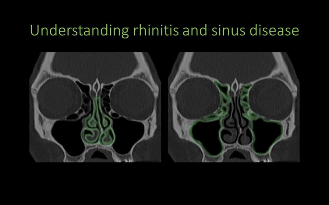 Nose and sinuses 101: all the basics you need to know