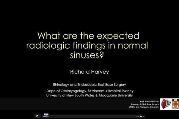 chronic sinus symptoms rhinitis