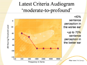 latest_criteria_audiogram_CI